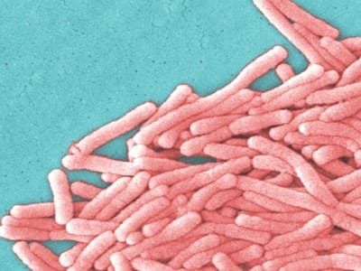 Legionella Legionella
